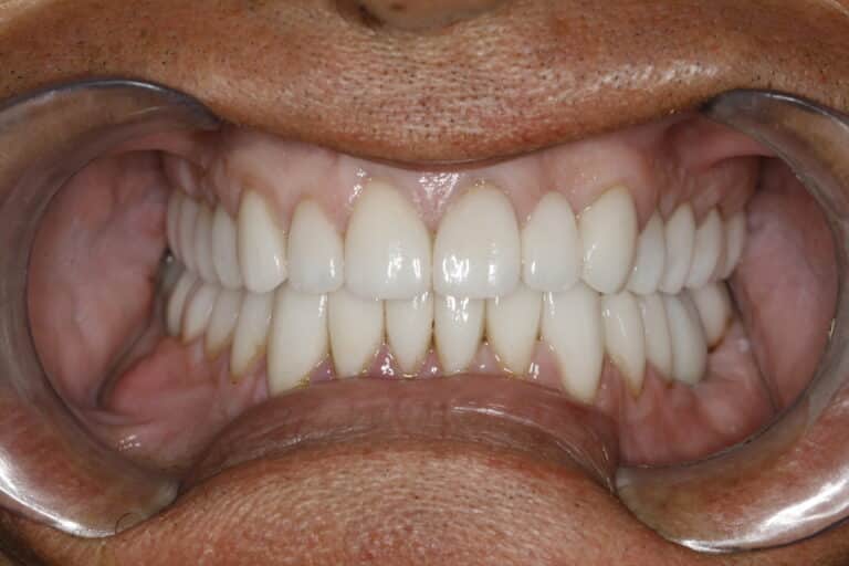 Konig Center for Cosmetic & Comprehensive Dentistry smile photos